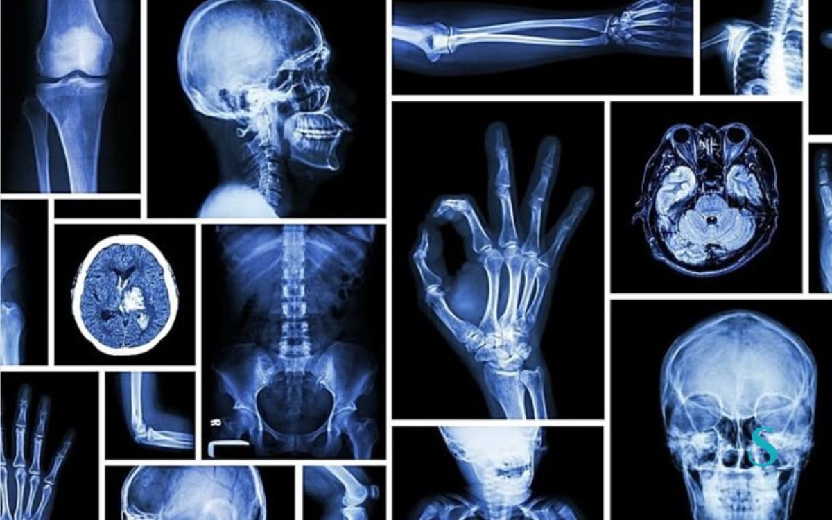 radiologia